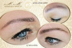 tetovalas-eltavolitas-szalas-szemoldok-Kiss-Katalin-sminktetovalas-Budapest-72